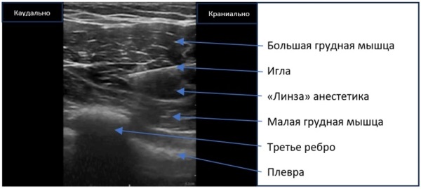 Изображение на обложке