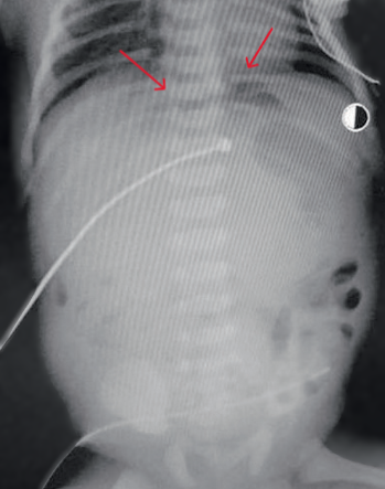Изображение на обложке