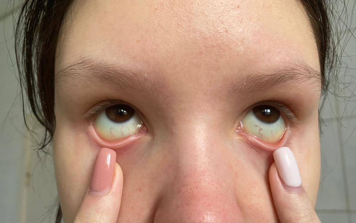 Изображение на обложке