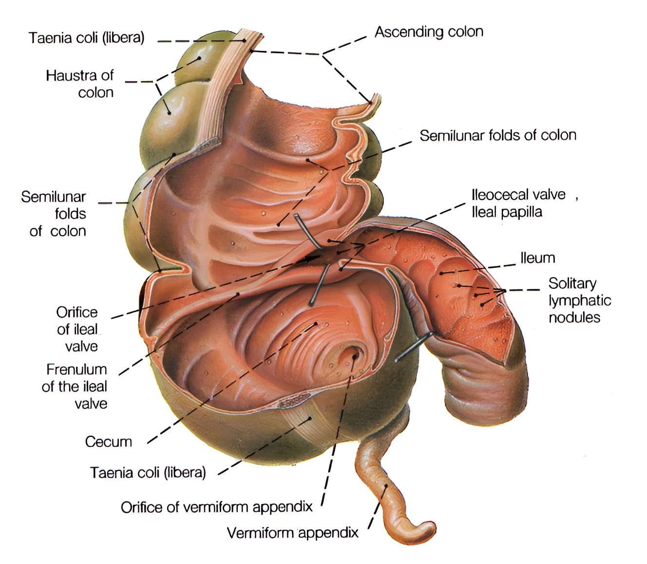 0101_Особенности ведения детей с кишечными стомами_рис 2.jpg